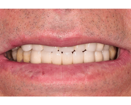 typeelementorsiteurlhttpsdemo.mantrayaglobal.inwp jsonelementsid49b69cfelTypewidgetisInnerfalseisLockedfalsesettingsbefore image labelBeforebefore imageurlhttpsdemo.mantrayaglobal.inwp 1