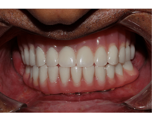 typeelementorsiteurlhttpsdemo.mantrayaglobal.inwp jsonelementsid49b69cfelTypewidgetisInnerfalseisLockedfalsesettingsbefore image labelBeforebefore imageurlhttpsdemo.mantrayaglobal.inwp 3