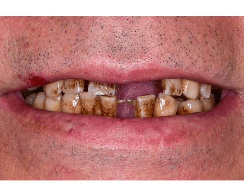 typeelementorsiteurlhttpsdemo.mantrayaglobal.inwp jsonelementsid49b69cfelTypewidgetisInnerfalseisLockedfalsesettingsbefore image labelBeforebefore imageurlhttpsdemo.mantrayaglobal.inwp