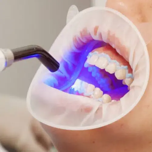 CAD CAM dentistry for precise and same-day digital dental restorations